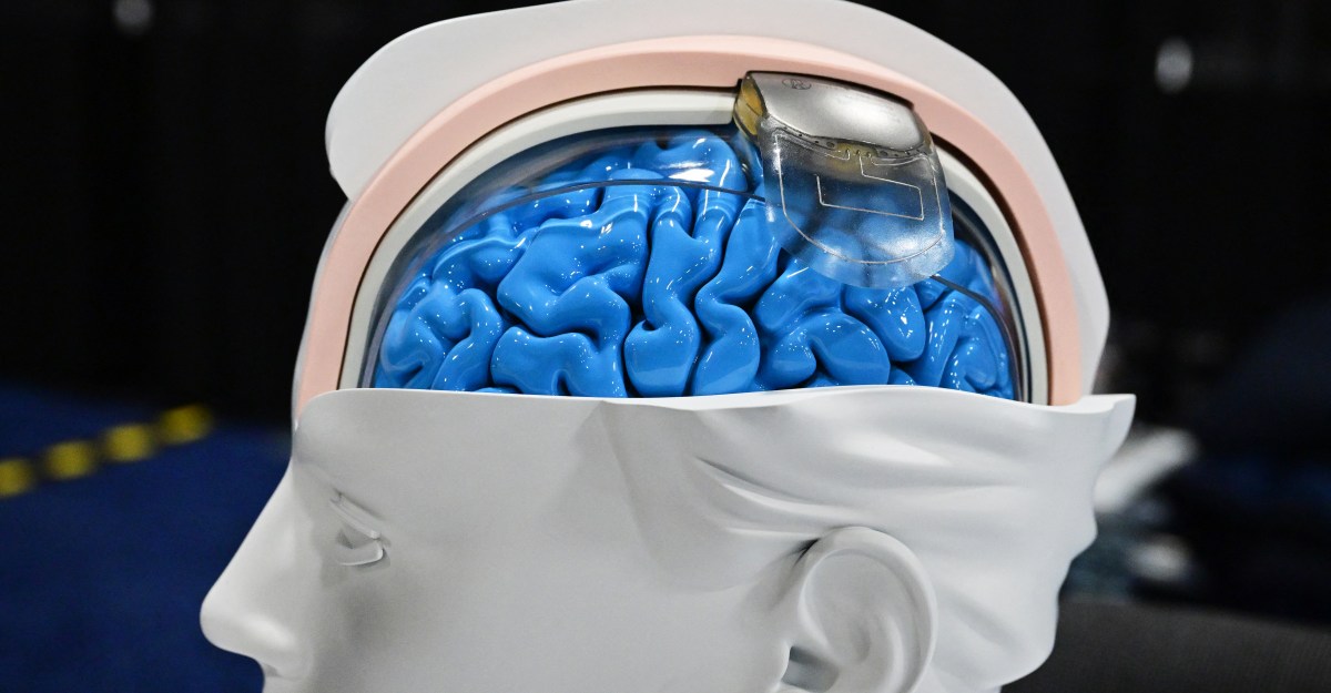 La revolución de la tecnología del cerebro está aquí, y no es todo el espejo negro