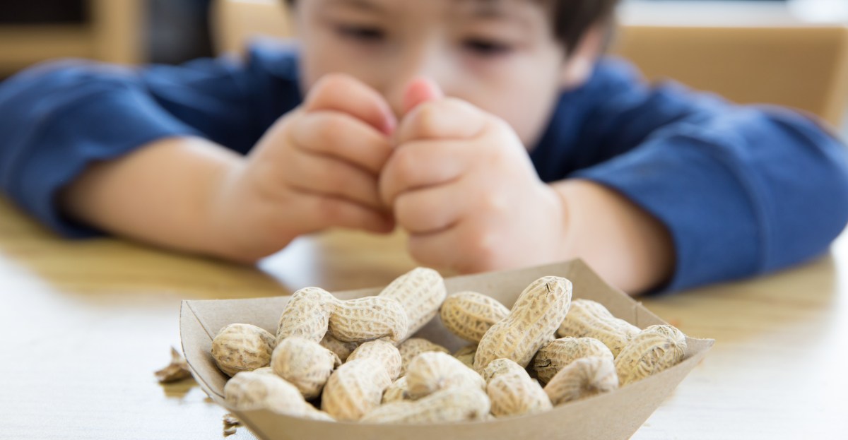Nuevos datos: la alimentación temprana con maní está reduciendo las alergias alimentarias de los niños