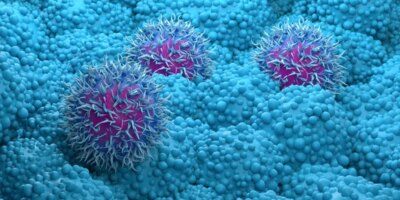 El cáncer de páncreas solía ser una sentencia de muerte. Pero los nuevos tratamientos nos están acercando a una cura.