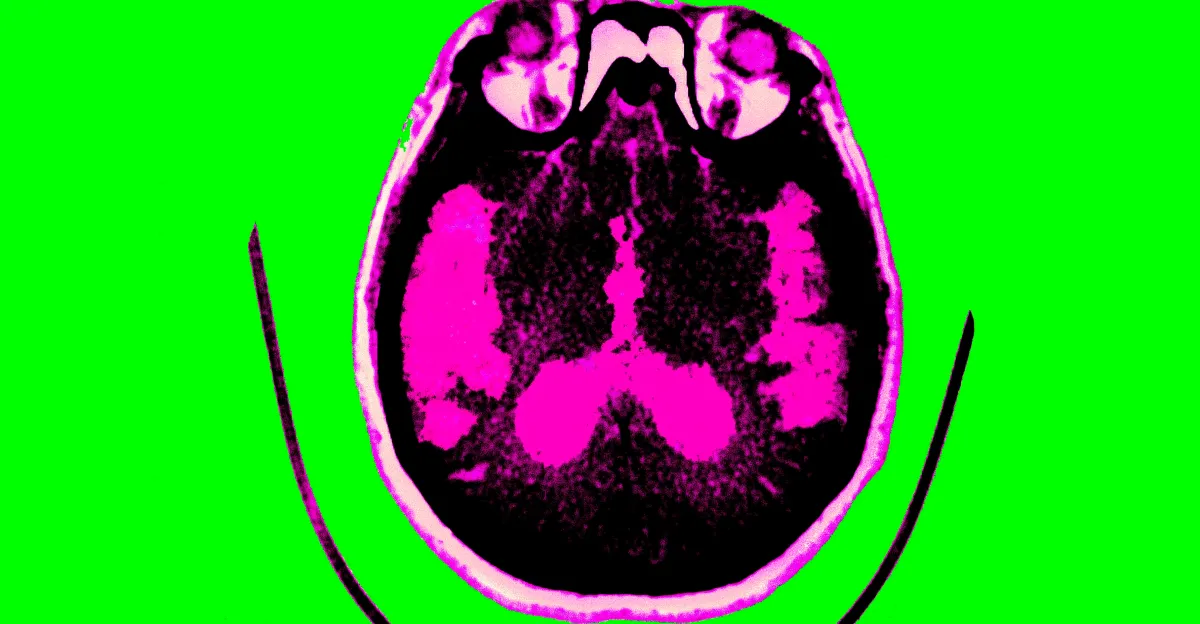 Buenas noticias sobre la investigación del Alzheimer, explicadas